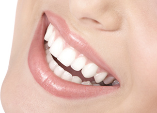 Dentista en las Rozas: carillas dentales de última generación