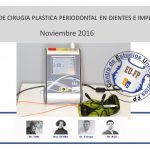 cartel-noviembre-cirugia-plastica-periodontal-fomento-profesional-dr-crespo